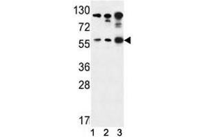 AKT1 antibody western blot analysis in (1) Jurkat, (2) A375, and (3) Y79 lysate