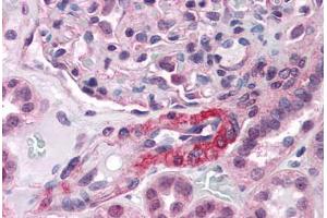 Human Kidney, Vessel: Formalin-Fixed, Paraffin-Embedded (FFPE)