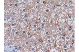 Detection of PLN in Human Liver Tissue using Polyclonal Antibody to Phospholamban (PLN)