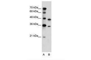 Image no. 2 for anti-phosphoribosyl Pyrophosphate Synthetase 2 (PRPS2) (AA 168-217) antibody (ABIN6736614) (PRPS2 anticorps  (AA 168-217))