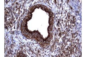 Image no. 11 for anti-Tumor Necrosis Factor Receptor Superfamily, Member 8 (TNFRSF8) (AA 19-379) antibody (ABIN1491084)