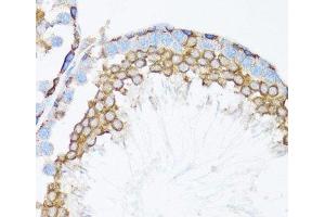 Immunohistochemistry of paraffin-embedded Mouse testis using CTNNA1 Polyclonal Antibody at dilution of 1:100 (40x lens).