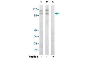 Western blot analysis of extracts from HepG2 cells (Lane 1) and HUVEC cells (Lane 2 and lane 3), using CDK11B polyclonal antibody .