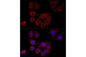 Immunofluorescence analysis of HeLa cells using CSF2RA antibody (ABIN3017509, ABIN3017510, ABIN3017511 and ABIN6220125) at dilution of 1:100 (40x lens).