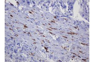 Immunohistochemistry (IHC) image for anti-Sterol O-Acyltransferase 2 (SOAT2) (AA 1-120) antibody (ABIN2715639) (SOAT2 anticorps  (AA 1-120))