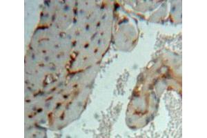 Used in DAB staining on fromalin fixed paraffin-embedded Heart tissue (MAPKAP Kinase 3 anticorps  (AA 129-329))