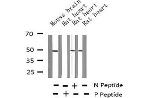 Western blot analysis of Phospho-HDAC8 (Ser39) expression in various lysates (HDAC8 anticorps  (pSer39))