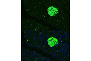Immunofluorescence analysis of mouse pancreas using SFRP5 Polyclonal Antibody (ABIN7270181) at dilution of 1:100 (40x lens).