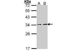 WB Image Sample (30 ug of whole cell lysate) A: Hep G2 , B: Molt-4 , 12% SDS PAGE antibody diluted at 1:1000 (ATP6V1E1 anticorps  (Center))