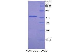 SDS-PAGE (SDS) image for Cyclin-Dependent Kinase 4 (CDK4) (AA 6-295) protein (His tag) (ABIN1879265)