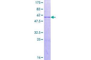 Image no. 1 for Aminocarboxymuconate Semialdehyde Decarboxylase (ACMSD) (AA 1-278) protein (GST tag) (ABIN1305646)