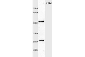 Human colon carcinoma lysate probed with Anti MMP1 Polyclonal Antibody, Unconjugated  at 1:3000 for 90 min at 37˚C. (MMP1 anticorps  (AA 401-469))