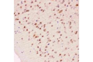 Anti-APE1 Picoband antibody, IHC(P): Mouse Brain Tissue