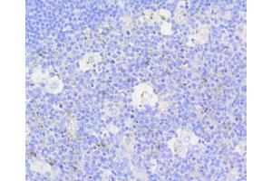 Immunohistochemistry of paraffin-embedded human tonsil using CASP3 antibody (ABIN4903137) at dilution of 1:100 (40x lens). (Caspase 3 anticorps)
