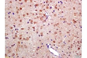 Formalin-fixed and paraffin embedded rat brain labeled with Anti-TNIP2 Polyclonal Antibody, Unconjugated (ABIN872901) at 1:200 followed by conjugation to the secondary antibody and DAB staining (TNIP2 anticorps  (AA 85-180))