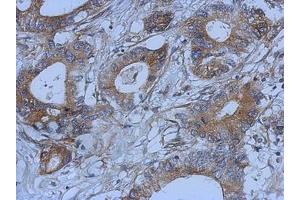 Image no. 1 for anti-D-Amino Acid Oxidase Activator (DAOA) (AA 1-153) antibody (ABIN1498354)