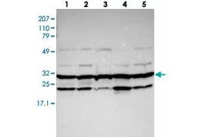 Western blot analysis of Lane 1: RT-4, Lane 2: EFO-21, Lane 3: U-138 MG, Lane 4: Liver, Lane 5: Tonsil with PSMA3 polyclonal antibody .