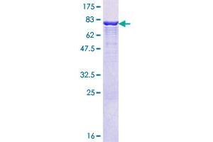 Image no. 1 for Intraflagellar Transport 57 Homolog (IFT57) (AA 1-429) protein (GST tag) (ABIN1307524)