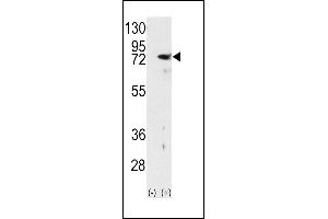 Western blot analysis of PKC delta (arrow) using rabbit polyclonal PKC delta Antibody (N-term) (ABIN391006 and ABIN2841179). (PKC delta anticorps  (N-Term))
