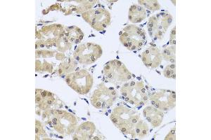 Immunohistochemistry of paraffin-embedded human stomach using cdc45 antibody (ABIN5971079) at dilution of 1/100 (40x lens). (CDC45 anticorps)