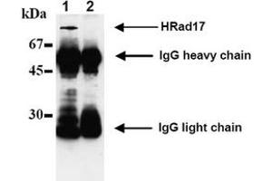 Western Blotting (WB) image for anti-RAD17 (RAD17) antibody (ABIN492574) (RAD17 anticorps)