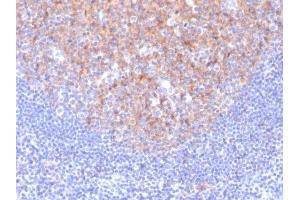 Formalin-fixed, paraffin-embedded human Tonsil stained with CD81 Mouse Monoclonal Antibody (1. (CD81 anticorps)