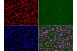 Immunofluorescence analysis of U2OS cell using RAD9A antibody. (RAD9A anticorps)