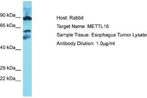Host: Rabbit Target Name: METTL16 Sample Type: Esophagus Tumor lysates Antibody Dilution: 1. (METTL16 anticorps  (Middle Region))