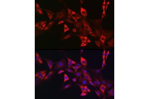 Immunofluorescence analysis of NIH/3T3 cells using CD117/c-Kit antibody (ABIN6133454, ABIN6142896, ABIN6142898 and ABIN6213818) at dilution of 1:50. (KIT anticorps  (AA 25-295))