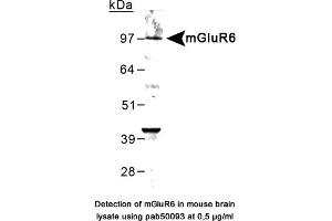 Image no. 1 for anti-Glutamate Receptor, Metabotropic 6 (GRM6) (C-Term) antibody (ABIN363402) (Metabotropic Glutamate Receptor 6 anticorps  (C-Term))