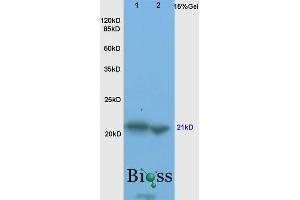 L1 rat brain, L2 mouse liver lysates probed (ABIN725390) at 1:200 in 4 °C.
