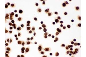 ICC testing of FFPE human SW480 cells with LMNB1 antibody. (Lamin B1 anticorps  (AA 266-583))