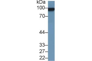 Western Blot; Sample: Rat Uterus lysate; Primary Ab: 1µg/ml Rabbit Anti-Rat MCAM Antibody Second Ab: 0.