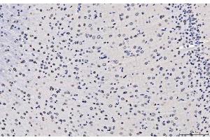 IHC analysis of TPR using anti-TPR antibody (ABIN7603243). (TPR anticorps  (N-Term))