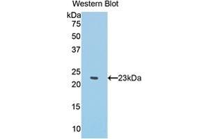 Western blot analysis of the recombinant protein. (IFNA anticorps  (AA 1-187))