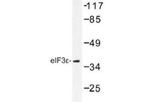 Image no. 1 for anti-Eukaryotic Translation Initiation Factor 3 Subunit E (EIF3E) antibody (ABIN317905)