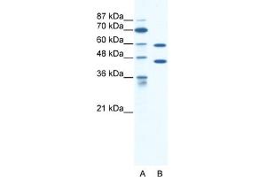 WB Suggested Anti-CATSPER2 Antibody Titration:  1. (CATSPER2 anticorps  (C-Term))