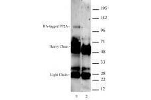 HA-Tag antibody (rAb) tested by Immunoprecipitation.