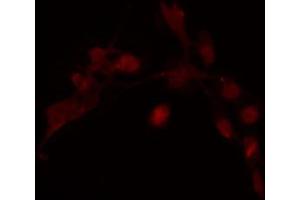 ABIN6274240 staining COLO205 cells by IF/ICC. (HOXD12 anticorps  (Internal Region))