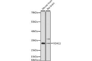 Western blot analysis of extracts of various cell lines, using VD antibody (ABIN7271336) at 1:1000 dilution.