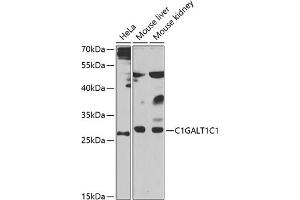 Western blot analysis of extracts of various cell lines, using C1GC1 antibody (ABIN6131024, ABIN6137748, ABIN6137749 and ABIN6223501) at 1:1000 dilution. (C1GALT1C1 anticorps  (AA 30-190))
