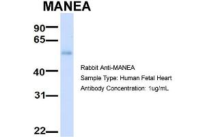 Host:  Rabbit  Target Name:  MANEA  Sample Type:  Human Fetal Heart  Antibody Dilution:  1.