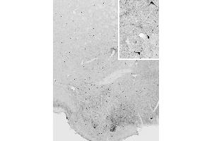 ABIN184662 immunostaining of NOS1 neurons in cryosection of a perfusion-fixed (4% PFA) mouse hypothalamus.