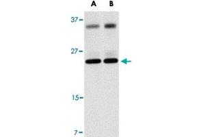 Western blot analysis of THEM4 in human liver tissue lysate with THEM4 polyclonal antibody  at (A) 1 and (B) 2 ug/mL . (THEM4 anticorps  (Internal Region))