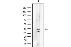 anti-Small Glutamine-Rich Tetratricopeptide Repeat (TPR)-Containing, alpha (SGTA) (C-Term) antibody