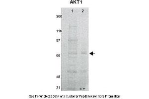 Lanes:   1. (AKT1 anticorps  (N-Term))
