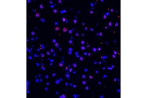 Immunofluorescence of paraffin embedded mouse brain using ZNF682 (ABIN7076270) at dilution of 1:400 (400x lens) (ZNF682 anticorps)