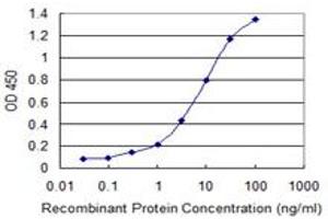 Detection limit for recombinant GST tagged CBX1 is 0.