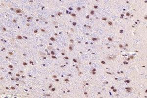 Immunohistochemistry analysis of paraffin-embedded ratsubstantia nigrausing PARC (ABIN7073606) at dilution of 1:1200