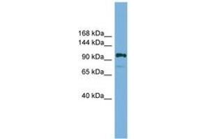 Image no. 1 for anti-HIR Histone Cell Cycle Regulation Defective Homolog A (HIRA) (AA 601-650) antibody (ABIN6744564) (HIRA anticorps  (AA 601-650))
